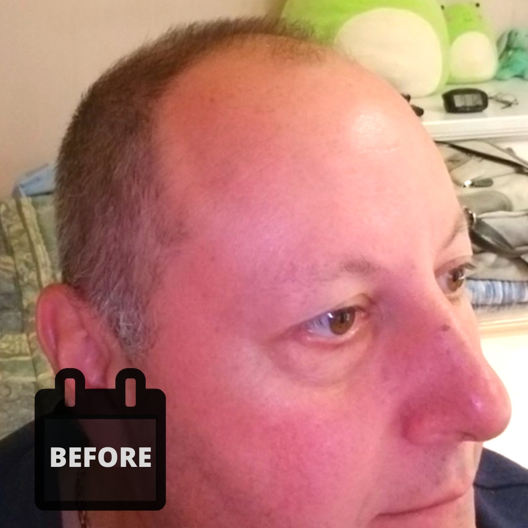 David-T-Before before transplant